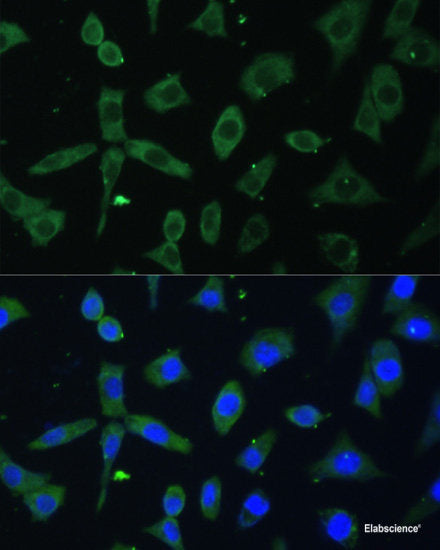 Immunohistochemistry of paraffin-embedded Human stomach using BNIP3L Polyclonal Antibody at dilution of  1:100 (40x lens).