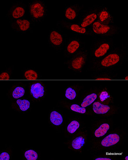 Immunohistochemistry of paraffin-embedded Mouse brain using GALT Polyclonal Antibody at dilution of  1:100 (40x lens).