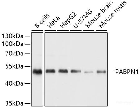 Immunohistochemistry of paraffin-embedded Human liver using SERPINA7 Polyclonal Antibody at dilution of  1:100 (40x lens).