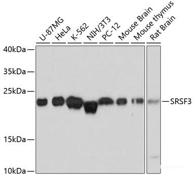 Immunohistochemistry of paraffin-embedded Rat brain using PDP1 Polyclonal Antibody at dilution of  1:100 (40x lens).