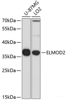 Immunohistochemistry of paraffin-embedded Human stomach using MYLK Polyclonal Antibody at dilution of  1:100 (40x lens).