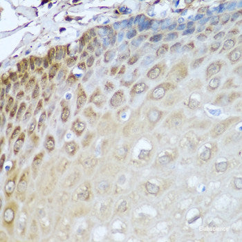Immunohistochemistry of paraffin-embedded Rat lung using IL36G Polyclonal Antibody at dilution of  1:100 (40x lens).