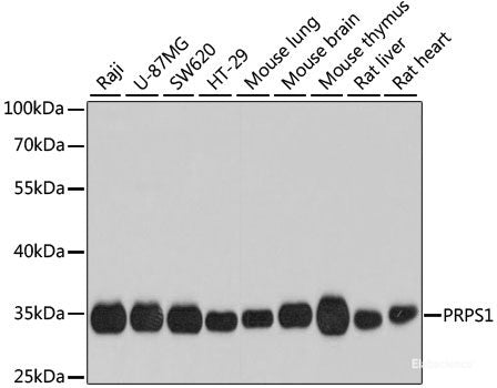 Immunohistochemistry of paraffin-embedded Mouse stomach using TAMM41 Polyclonal Antibody at dilution of  1:100 (40x lens).