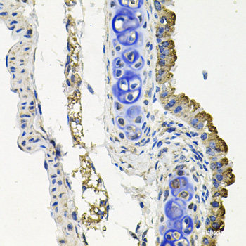 Confocal immunofluorescence analysis of U2OS cells using SEPT9 Polyclonal Antibody at dilution of  1:100. Blue: DAPI for nuclear staining.