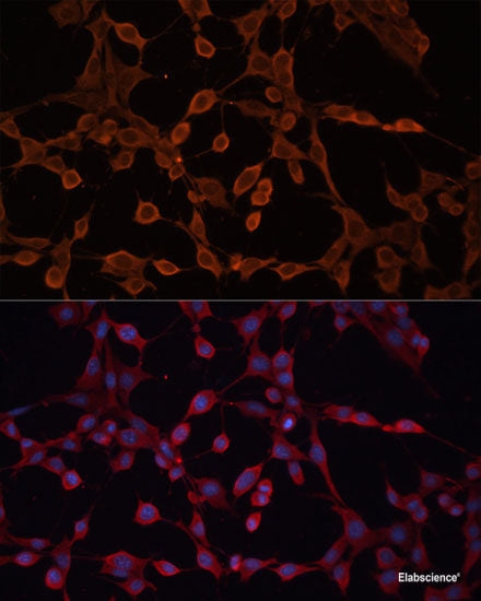 Immunohistochemistry of paraffin-embedded Rat heart using RPIA Polyclonal Antibody at dilution of  1:100 (40x lens).