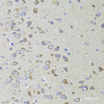 Immunofluorescence analysis of L929 cells using USP19 Polyclonal Antibody at dilution of  1:100. Blue: DAPI for nuclear staining.