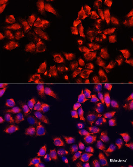 Immunohistochemistry of paraffin-embedded Mouse brain using CHRNB2 Polyclonal Antibody at dilution of  1:100 (40x lens).