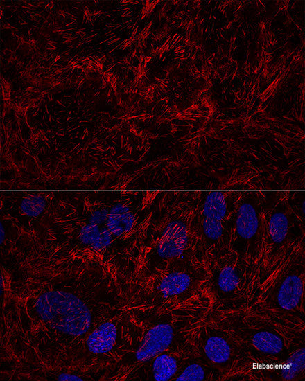 Western blot analysis of extracts of various cell lines using HOXA13 Polyclonal Antibody at dilution of 1:1000.