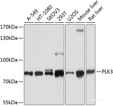 Immunohistochemistry of paraffin-embedded Human prostate using LCN1 Polyclonal Antibody at dilution of  1:100 (40x lens).