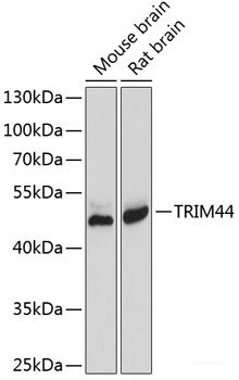 Immunohistochemistry of paraffin-embedded Rat kidney using MYO5A Polyclonal Antibody at dilution of  1:100 (40x lens).