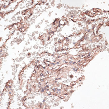 Immunohistochemistry of paraffin-embedded Mouse brain using BAF60a Polyclonal Antibody at dilution of  1:100 (40x lens).