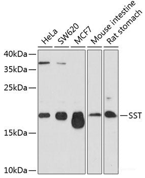 Immunohistochemistry of paraffin-embedded Human mammary cancer using SOCS6 Polyclonal Antibody at dilution of  1:100 (40x lens).