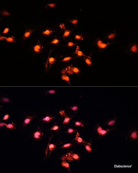 Immunohistochemistry of paraffin-embedded Human colon using TRIP12 Polyclonal Antibody at dilution of  1:100 (40x lens).
