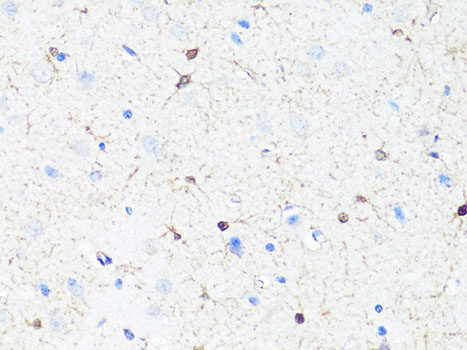Immunofluorescence analysis of NIH/3T3 cells using GSK3A Polyclonal Antibody at dilution of  1:100. Blue: DAPI for nuclear staining.