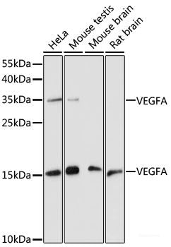Immunohistochemistry of paraffin-embedded Mouse lung using PI3 Kinase p110 beta Polyclonal Antibody at dilution of  1:100 (40x lens).