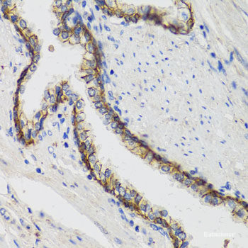 Immunohistochemistry of paraffin-embedded Mouse stomach using MSMB Polyclonal Antibody at dilution of  1:100 (40x lens).