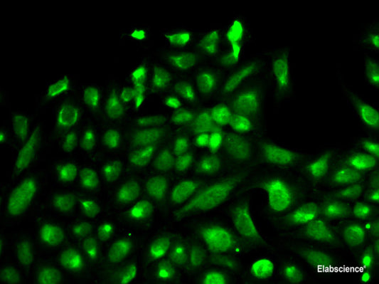 Western blot analysis of extracts of Mouse brain using ATP2B4 Polyclonal Antibody at dilution of 1:1000.