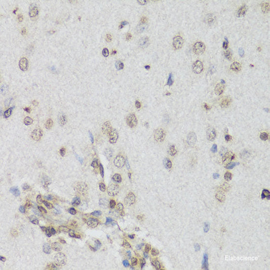 Western blot analysis of extracts of various cell lines using INPPL1 Polyclonal Antibody at dilution of 1:1000.