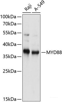 Immunofluorescence analysis of C6 cells using GPER1 Polyclonal Antibody at dilution of  1:100. Blue: DAPI for nuclear staining.