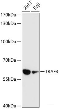Western blot analysis of extracts of various cell lines using TPD52 Polyclonal Antibody at dilution of 1:1000.