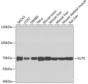 Immunohistochemistry of paraffin-embedded Human breast cancer using EIF3B Polyclonal Antibody at dilution of  1:100 (40x lens).