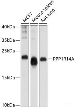 Immunofluorescence analysis of U-2 OS cells using SEC14L2 Polyclonal Antibody at dilution of  1:100 (40x lens). Blue: DAPI for nuclear staining.