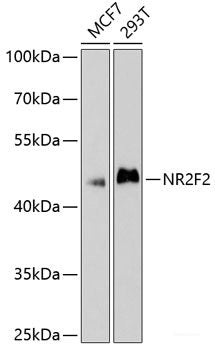 Immunofluorescence analysis of Human placenta cells using MYH11 Polyclonal Antibody at dilution of  1:100. Blue: DAPI for nuclear staining.