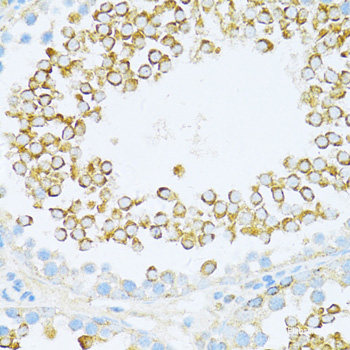 Immunofluorescence analysis of HeLa cells using HDAC6 Polyclonal Antibody at dilution of  1:100 (40x lens). Blue: DAPI for nuclear staining.