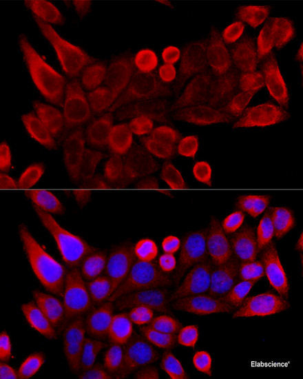 Immunohistochemistry of paraffin-embedded Rat liver using YAP1 Polyclonal Antibody at dilution of  1:100 (40x lens).