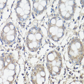 Immunohistochemistry of paraffin-embedded Rat testis using DDX3Y Polyclonal Antibody at dilution of  1:100 (40x lens).