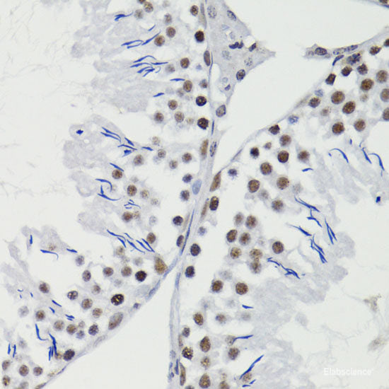 Immunofluorescence analysis of HeLa cells using CAT Polyclonal Antibody at dilution of  1:100. Blue: DAPI for nuclear staining.