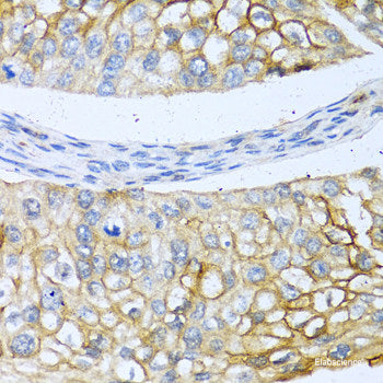 Immunofluorescence analysis of C6 cells using TLR3 Polyclonal Antibody at dilution of  1:100. Blue: DAPI for nuclear staining.