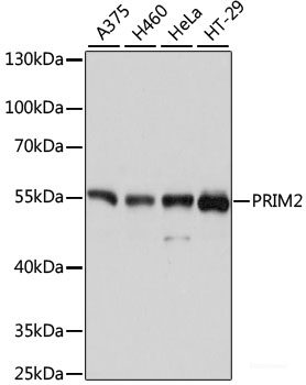 Immunohistochemistry of paraffin-embedded Human prostate using DEFB121 Polyclonal Antibody at dilution of  1:100 (40x lens).