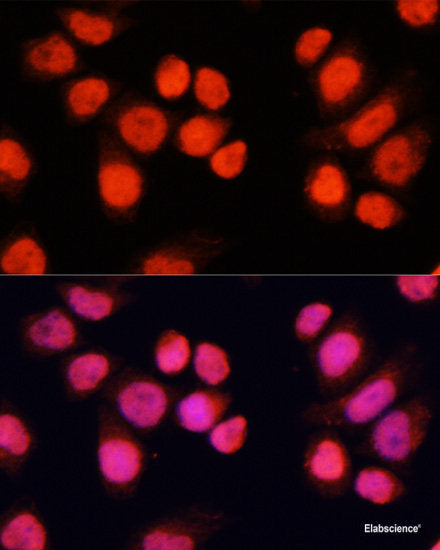 Immunohistochemistry of paraffin-embedded Rat heart using CA3 Polyclonal Antibody at dilution of  1:100 (40x lens).