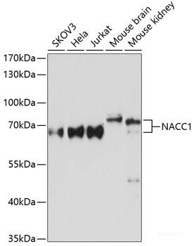 Western blot analysis of extracts of various cell lines using LILRB2 Polyclonal Antibody at dilution of 1:3000.