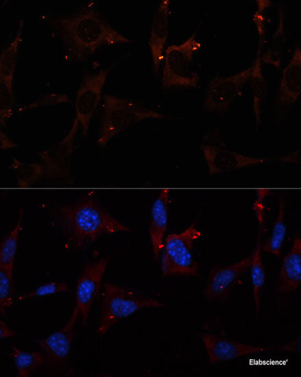 Immunohistochemistry of paraffin-embedded Mouse kidney using SRPX Polyclonal Antibody at dilution of  1:100 (40x lens).