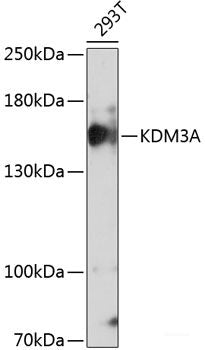 Immunohistochemistry of paraffin-embedded Mouse brain using CHRM1 Polyclonal Antibody at dilution of  1:100 (40x lens).