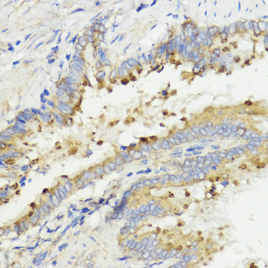 Immunohistochemistry of paraffin-embedded Human tonsil using SPTA1 Polyclonal Antibody at dilution of  1:100 (40x lens).