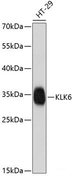 Immunohistochemistry of paraffin-embedded Human prostate using ApoE Polyclonal Antibody at dilution of  1:100 (40x lens).