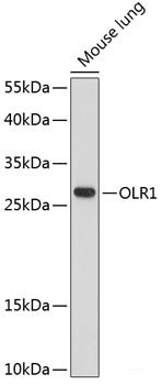 Immunofluorescence analysis of C6 cells using ATP1B1 Polyclonal Antibody at dilution of  1:100. Blue: DAPI for nuclear staining.
