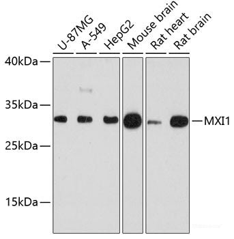 Immunohistochemistry of paraffin-embedded Rat pancreas using FLT3 Polyclonal Antibody at dilution of  1:100 (40x lens).