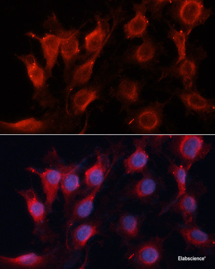 Immunohistochemistry of paraffin-embedded Mouse lung using TOPBP1 Polyclonal Antibody at dilution of  1:100 (40x lens).