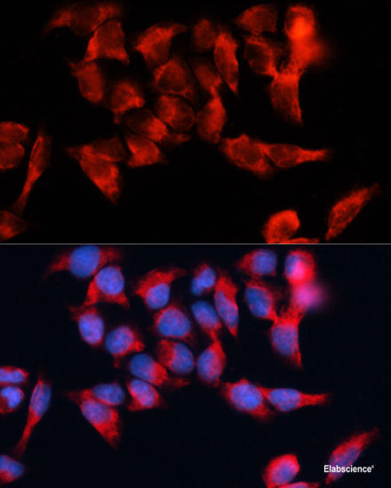 Immunohistochemistry of paraffin-embedded Mouse kidney using JADE1 Polyclonal Antibody at dilution of  1:100 (40x lens).