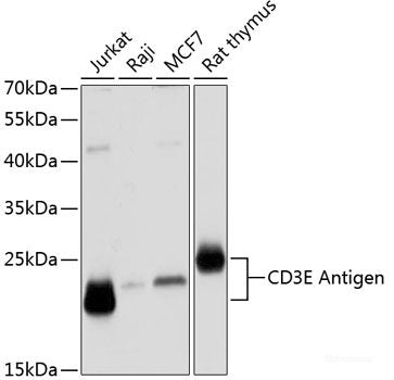 Immunofluorescence analysis of C6 cells using PSME3 Polyclonal Antibody at dilution of  1:100 (40x lens). Blue: DAPI for nuclear staining.