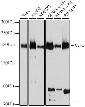 Immunofluorescence analysis of NIH/3T3 cells using CD133 Polyclonal Antibody at dilution of  1:100. Blue: DAPI for nuclear staining.