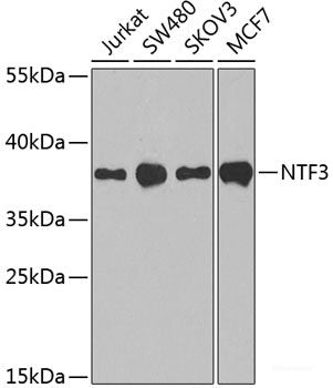 Immunohistochemistry of paraffin-embedded Rat brain using TH Polyclonal Antibody at dilution of  1:200 (40x lens).