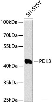 Immunohistochemistry of paraffin-embedded Rat lung using NAT2 Polyclonal Antibody at dilution of  1:100 (40x lens).