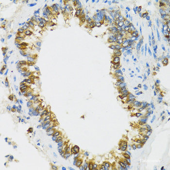 Immunohistochemistry of paraffin-embedded Rat spleen using VEGF Receptor 1 Polyclonal Antibody at dilution of  1:100 (40x lens).