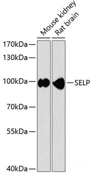 Immunohistochemistry of paraffin-embedded Human liver using GPC4 Polyclonal Antibody at dilution of  1:100 (40x lens).