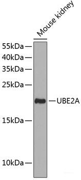 Immunofluorescence analysis of Mouse brain using SNX13 Polyclonal Antibody at dilution of  1:100. Blue: DAPI for nuclear staining.